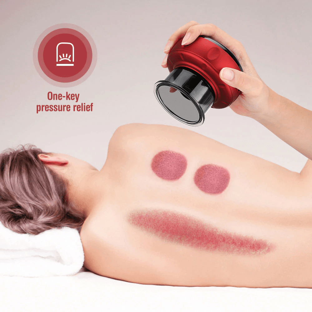 SmartMassage™ Vacuum Cupping